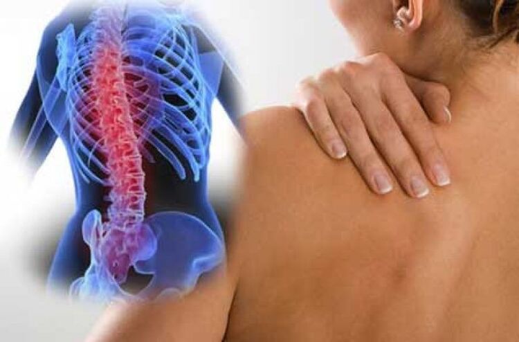 Με την οστεοχονδρωσία, ο πόνος μπορεί να ακτινοβολεί σε απομακρυσμένες περιοχές του σώματος