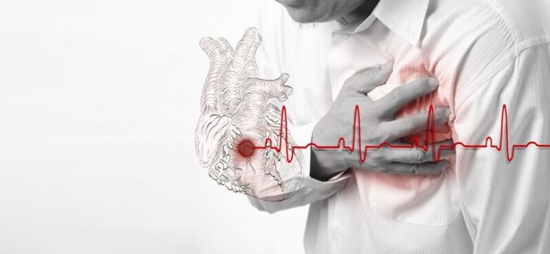 Καρδιακή προσβολή ως αιτία πόνου κάτω από την αριστερή ωμοπλάτη