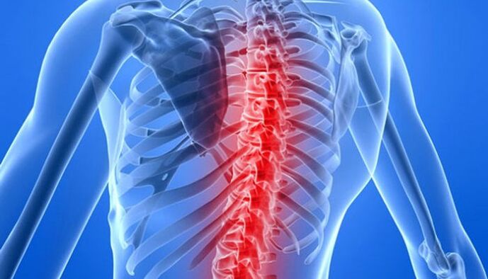 Οι παθολογίες της σπονδυλικής στήλης είναι η πιο κοινή αιτία πόνου στην πλάτη στην περιοχή της ωμοπλάτης